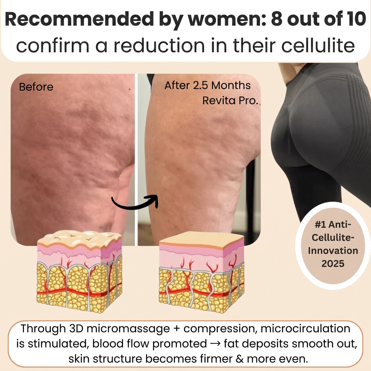 FEMILLIE PRO – Compressieleggings met een calorieverbrandend effect en huidverstevigende eigenschappen