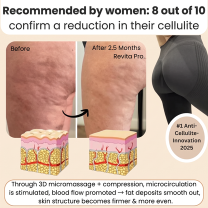 FEMILLIE PRO – Compressieleggings met een calorieverbrandend effect en huidverstevigende eigenschappen
