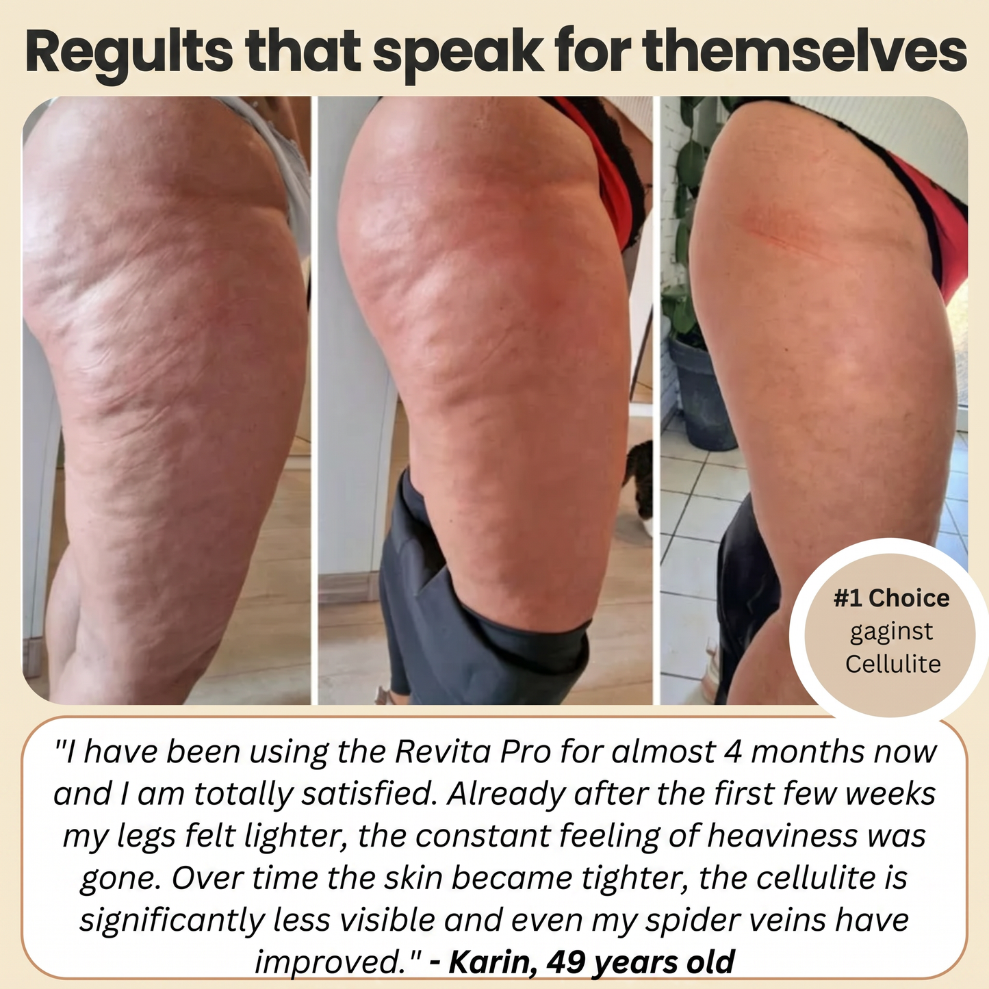 FEMILLIE PRO – Compressieleggings met een calorieverbrandend effect en huidverstevigende eigenschappen