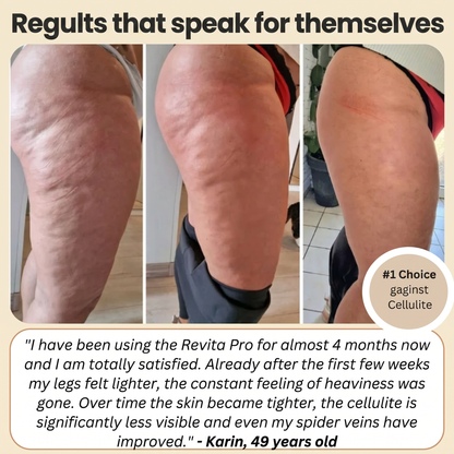FEMILLIE PRO – Compressieleggings met een calorieverbrandend effect en huidverstevigende eigenschappen